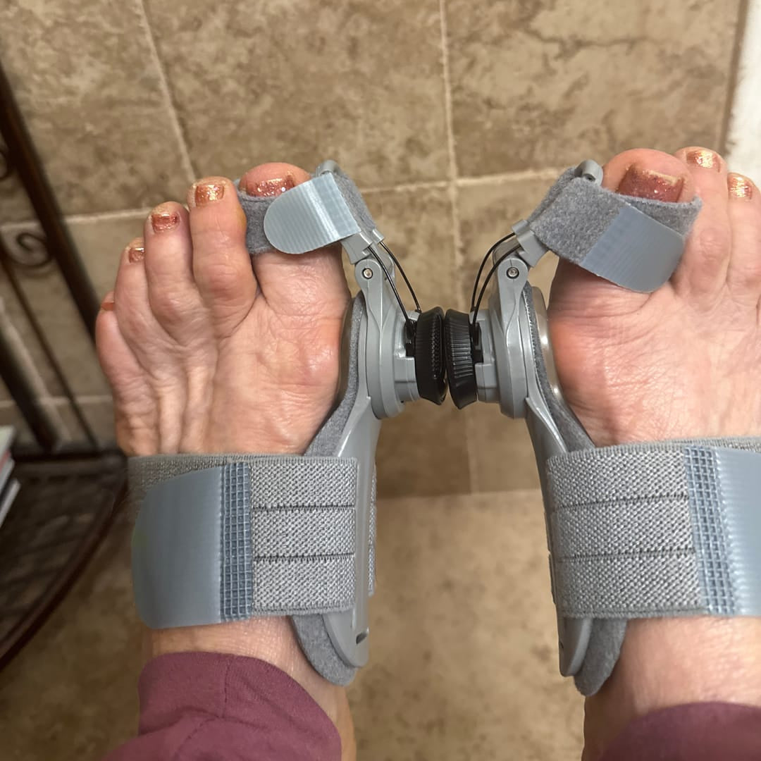 BunionRelief