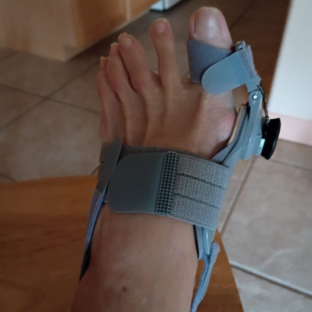 BunionRelief